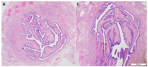 Figure 3. Photomicrographs of Bilateral Fallopian Tube Cross-Sections. Histologically unremarkable. (H&E, 40X)