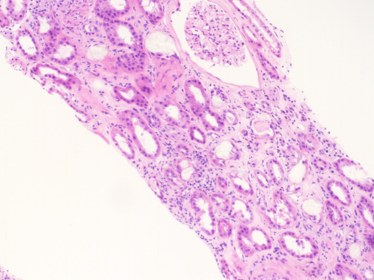 Kidney Biopsy Light microscopy
