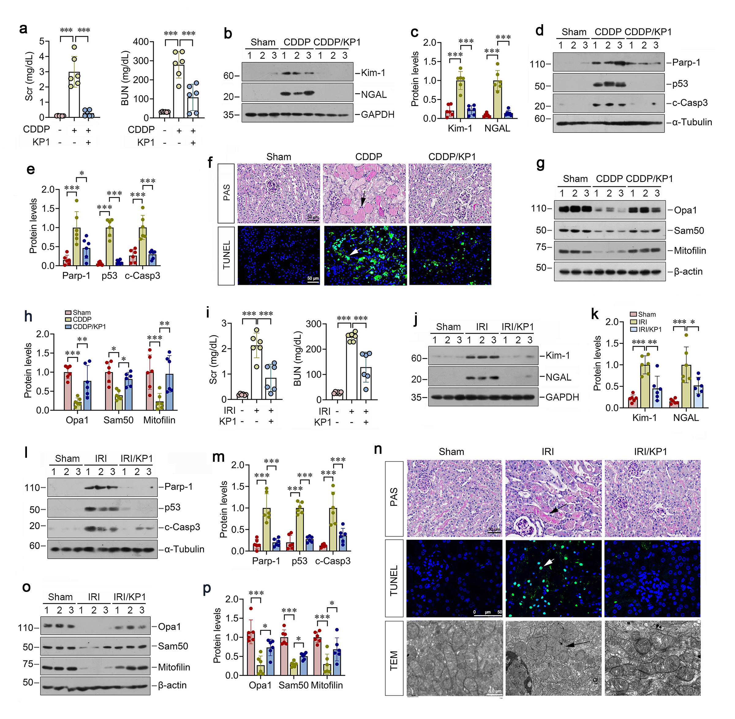 Figure 1. KP1 protects against both nephrotoxic and ischemic AKI in mice. (a) Graphic presentation shows the serum creatinine (Scr) and blood urea nitrogen (BUN) levels in CDDP mice after KP1 treatment. (b, c) Western blotting analysis for Kim-1 and NGAL protein levels in CDDP mice after KP1 treatment. (d, e) Western blotting analysis for Parp-1, p53 and c-Casp3 protein levels in CDDP mice after KP1 treatment. (f) Representative Acid-Schiff (PAS) and TUNEL staining micropraghs in CDDP mice after KP1 treatment. Scale bar, 50 µm. (g) Representative Western blot analyses of Opa1, Sam50 and mitofilin protein levels in IRI mice after KP1 treatment. (h) Quantitative data of Opa1, Sam50 and mitofilin protein levels in IRI mice after KP1 treatment. (i) Graphic presentation shows the Scr and BUN levels in IRI mice after KP1 treatment. (j, k) Western blotting analysis for Kim-1 and NGAL protein levels in IRI mice after KP1 treatment. (l, m) Western blotting analysis for Parp-1, p53 and c-Casp3 protein levels in IRI mic