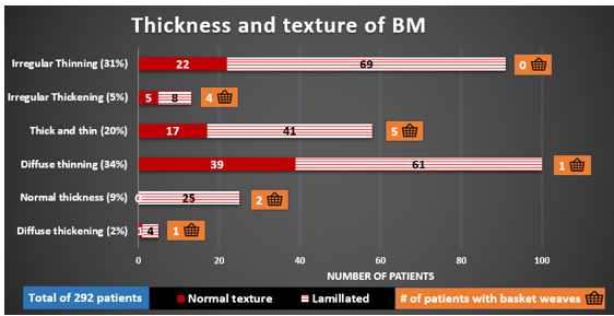Figure 1: Spectrum of GBM abnormalities. Diffuse thinning was the largest group with 100 patients (34%); 39 had normal texture, and 61 had lamellations, 1 of those with lamellations had a basket-weaves appearance.