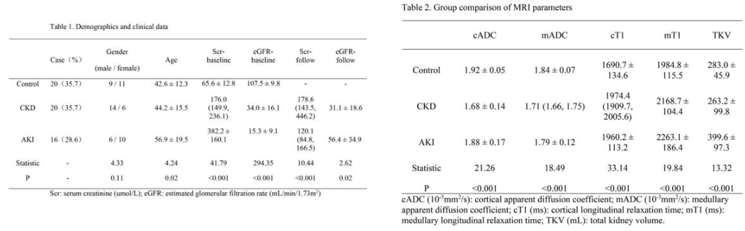 table