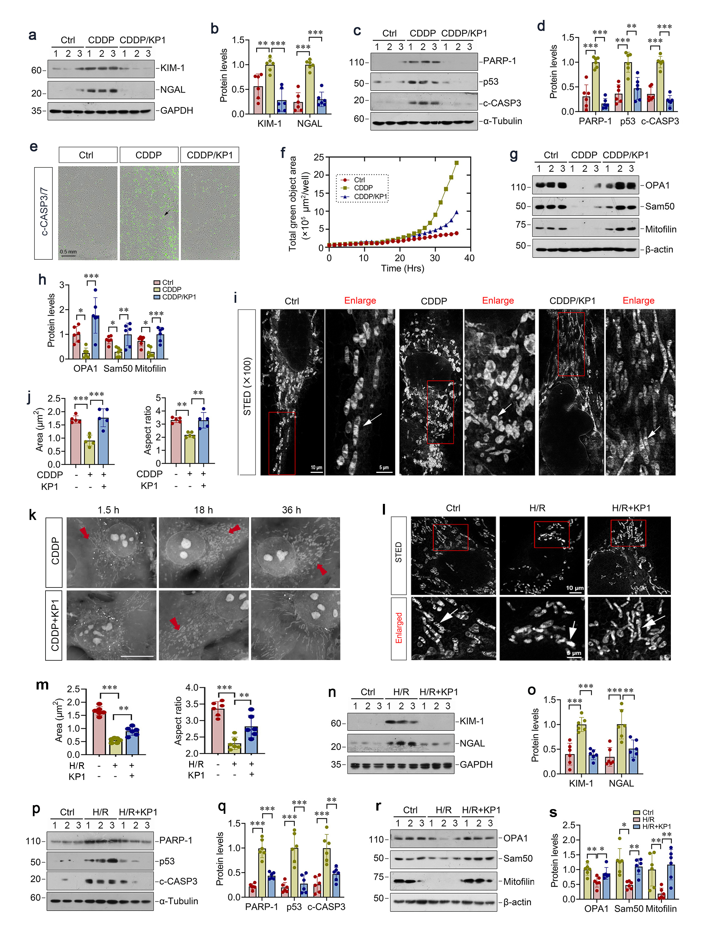 Figure 2. KP1 prevents renal tubular injury and mitochondrial disfunction in vitro. (a, b) Representative Western blot (a) and quantitative data (b) showed that KP1 abolished the induction of KIM-1 and NGAL proteins in CDDP-stimulated HKC-8 cells with KP1 treatment. (c, d) Representative Western blot (c) and quantitative data (d) showed that KP1 abolished the induction of PARP-1, p53 and c-CASP3 proteins in CDDP-stimulated cells with KP1 treatment. (e) Representative high-throughput live cell images showed the positive staining for cleaved caspase-3/7 in CDDP-stimulated cells with KP1 treatment at 24 h. Scale bar, 0.5 mm. (f) Displays the intensity of CASP3/7-positive green fluorescence signals over time (μm²/well). (g, h) Representative Western blot (g) and quantitative data (h) showed that KP1 restored OPA1, Sam50 and mitofilin protein levels in CDDP-stimulated HKC-8 cells with KP1 treatment. (i) Representative stimulated emission depletion (STED) micrographs showed the positive staining for mitochondria in