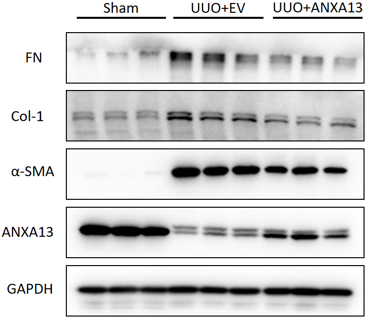 Overexpression of ANXA13 considerably mitigate renal fibrosis.