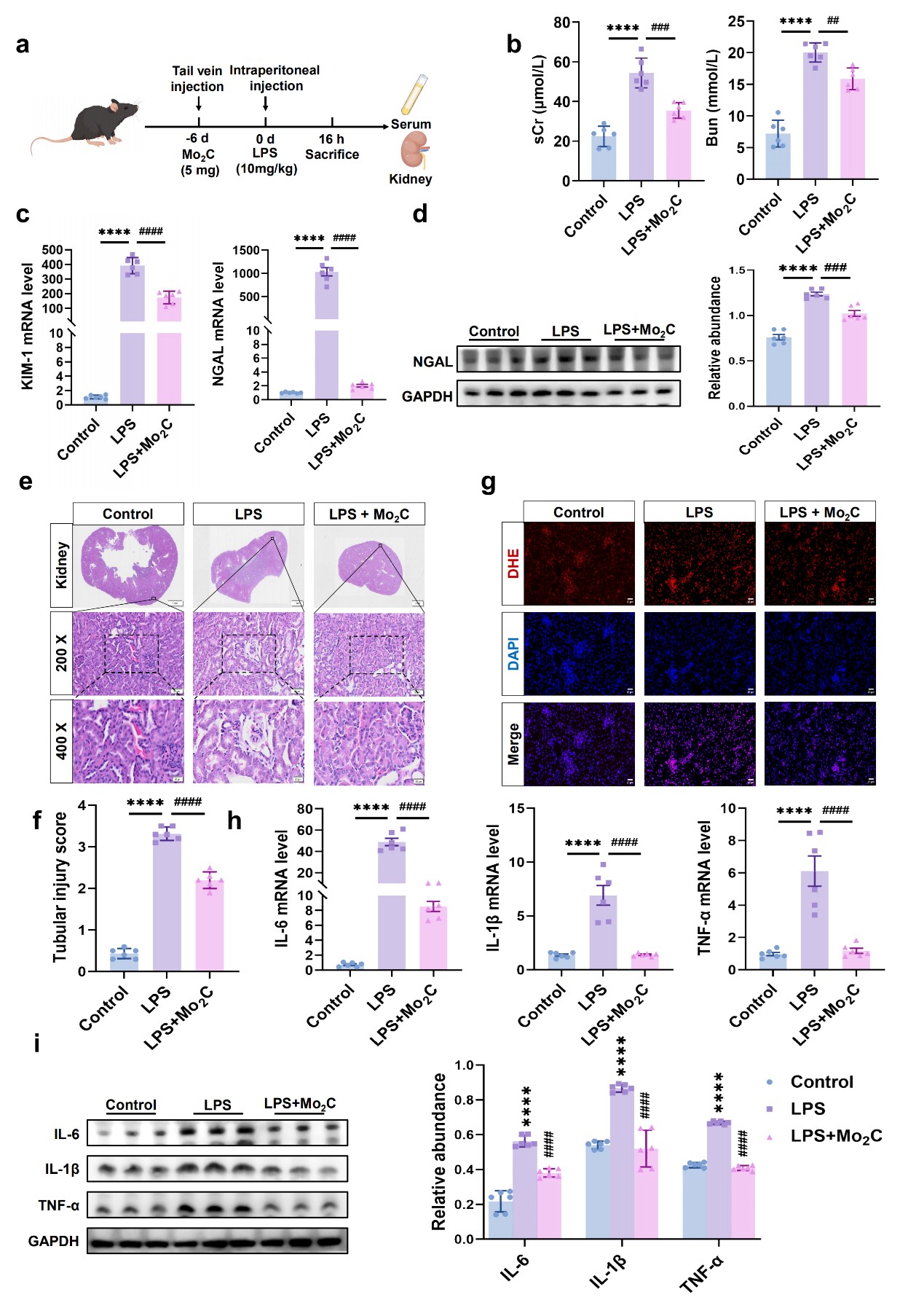 Mo2C nanozyme protects renal function, ameliorates oxidative stress and inflammation in S-AKI mice.