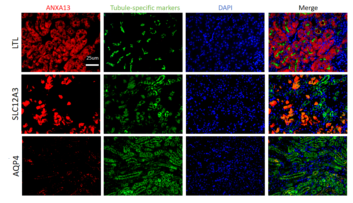 ANXA13 is primarily expressed in proximal tubular epithelial cells