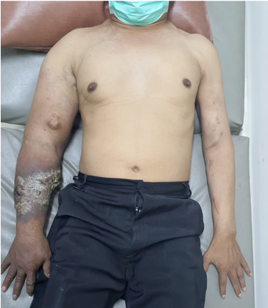 Figure 1. Clinical Presentation