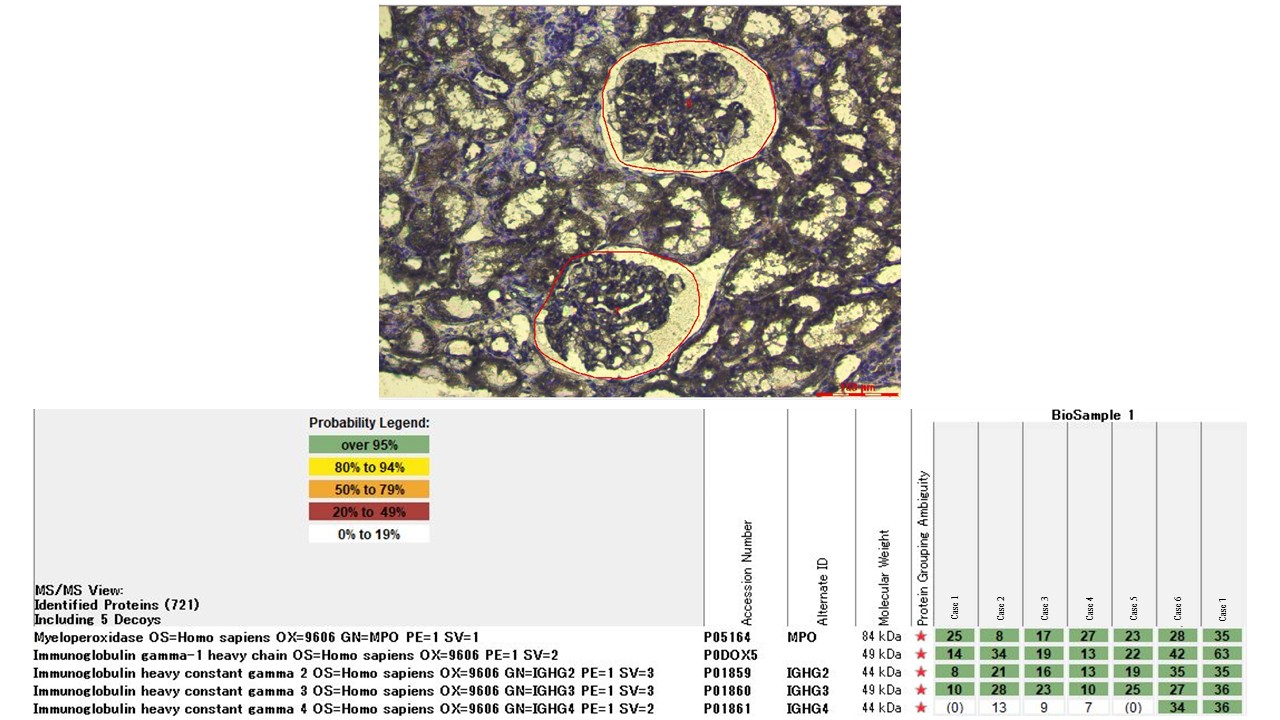 Marked for microdissection, Tandem mass spectrometry results