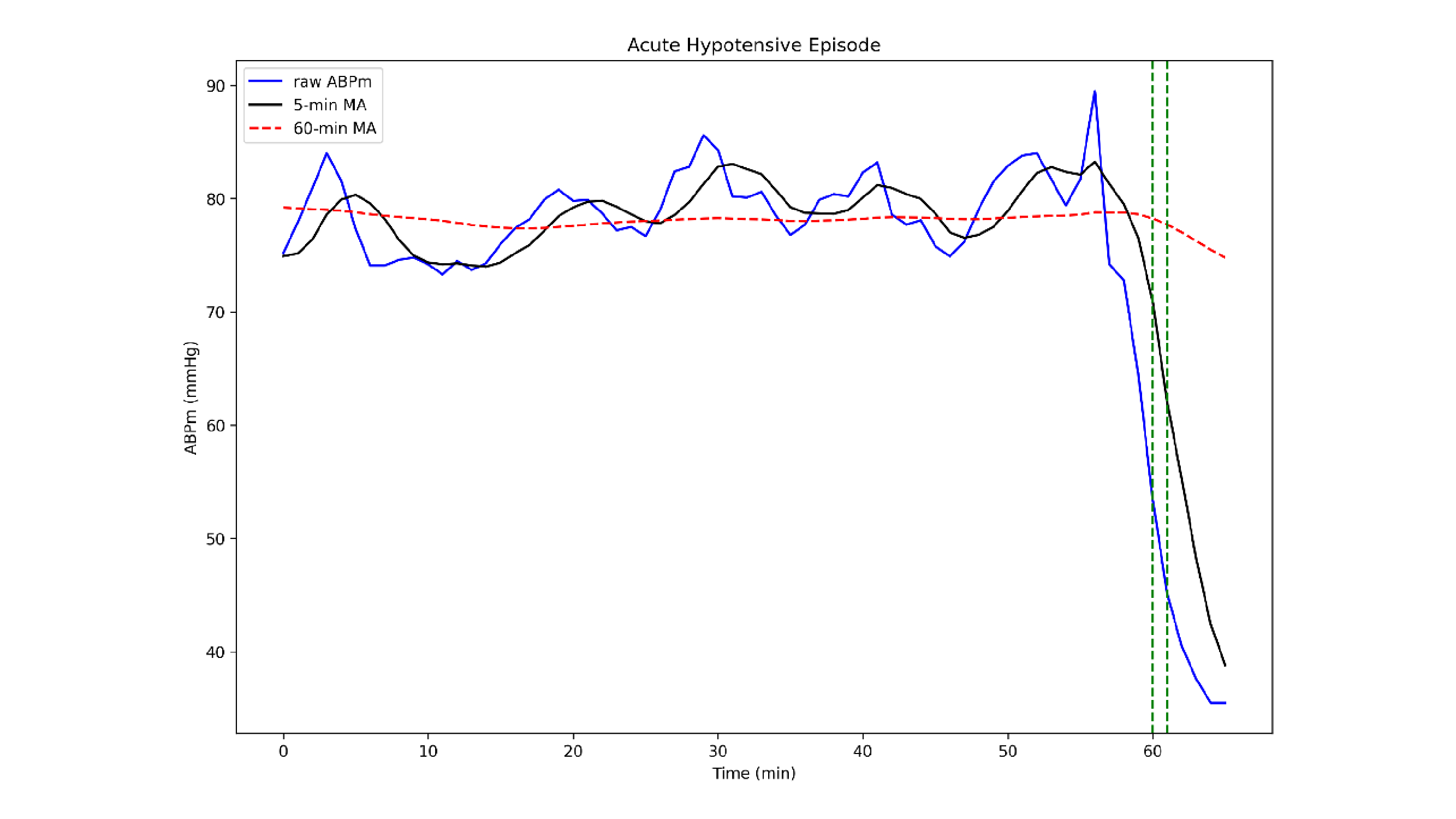 An example of hypotension definition using a personalized approach which studies the drop between 2 moving averages of the raw signal. The sequence, split into three different windows, shows the trend of Arterial Blood Pressure Mean (ABPm) (blue), the 60-minute moving average of ABPm (red) and the 5-minute moving average of ABPm (black). In the target window the drop percentage between the two MA is at least 20% for all TW’s values, so this sequence represents an example of hypotensive episode