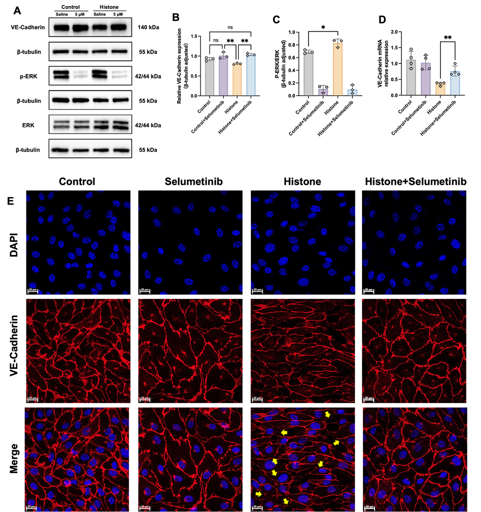 Figure 6  MEK inhibitor alleviated histone-induced endothelial barrier disruption in vitro. (A-D) Treatment with selumetinib successfully ameliorated histone-induced decreased expression of VE-Cadherin via inhibiting the activation of MEK-ERK. (E) Treatment with selumetinib significantly stabilized the integrity of endothelial barrier (scale bars = 20 μm; yellow arrow indicated discontinuous VE-Cadherin staining). Data are represented as the mean ± SD. *P ＜ 0.05, ** P ＜0.01, *** P ＜0.001, **** P＜0.0001.