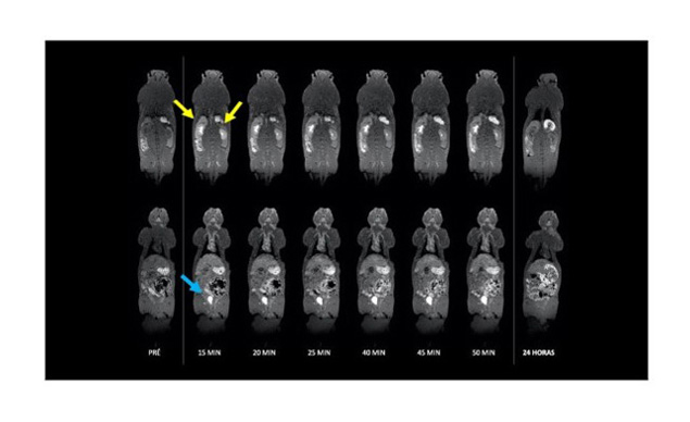 Figure1. Anatomical coronal T2-weighted MRI images of a Wistar rat before (pre-contrast) and 15, 20, 25, 40, 45, and 50 minutes, and also 24 hours after intravenous injection by infusion of PNPs. The series of images in the upper and lower rows shows the arrival and accumulation of the contrast agent, respectively, in the renal calyx (yellow arrow) and in the bladder (blue arrow).
