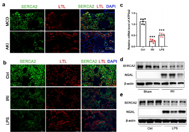 (a) Immunofluorescence of SERCA2 (green) in proximal tubules (LTL, red) of kidney sections from AKI patients and minimal change disease (MCD) patients. (b) Immunofluorescence of SERCA2 (green) in proximal tubules (LTL, red) of kidney sections from control (Ctrl) and  AKI mouse models (200×, scale bar = 100 μm). (c) Relative mRNA expression of ATP2a2 in control (Ctrl) and  AKI mouse kidney samples. (d) Western blot analysis of SERCA2 and neutrophil gelatinase-associated lipocalin (NGAL) expression in kidney  from Sham and IRI-induced AKI mice. (e) Western blot analysis of SERCA2 and NGAL expression in kidney from Ctrl and lipopolysaccharide (LPS)-induced AKI mice.