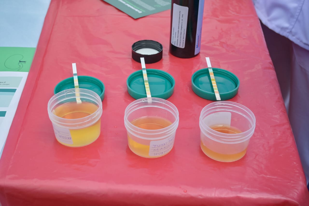 urine test