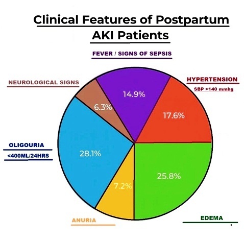 Figure 2 shows that clinical features of PPAK.  Oliguria, defined as urine output less than 400 mL in 24 hours, was the most common presenting symptom, observed in 28.1% of cases. This was followed closely by edema, seen in 25.8% of patients, indicating significant fluid retention. Hypertension (systolic blood pressure >140 mmHg) was reported in 17.6% of the cohort, suggesting a potential link with hypertensive disorders of pregnancy such as preeclampsia. Fever or signs of sepsis were present in 14.9%, emphasizing the role of infectious etiologies in the pathogenesis of PPAKI. Anuria and neurological symptoms were less frequently encountered, accounting for 7.2% and 6.3% of cases, respectively, and were likely reflective of more severe systemic involvement or multiorgan dysfunction. These findings highlight the importance of early recognition of volume and blood pressure abnormalities in the clinical assessment of PPAKI.