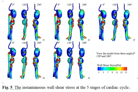 The instantaneous wall shear stress at the 5 stages of cardiac cycle