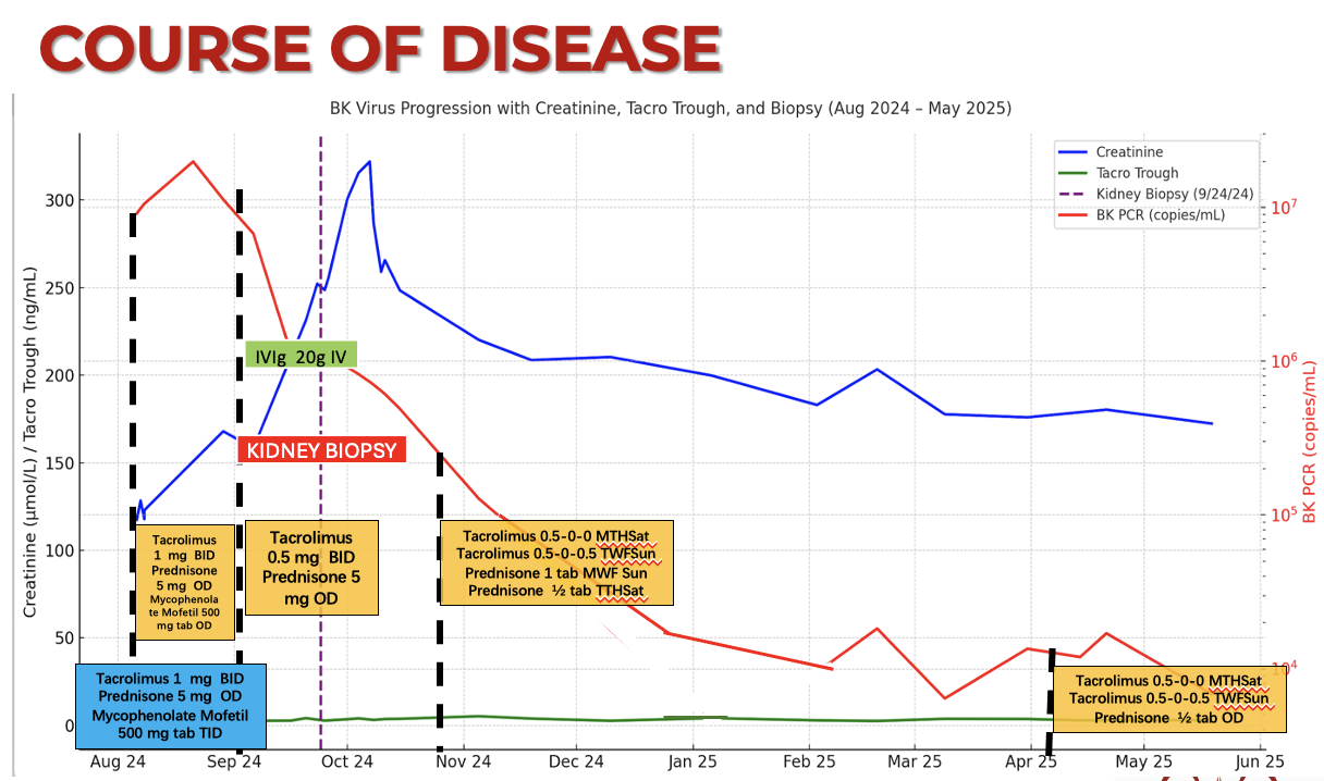 Figure 2: Longitudinal Clinical and Virologic Course in a Kidney Transplant Recipient with BK Virus Nephropathy. The graph illustrates the patient’s serum creatinine (blue line), tacrolimus trough levels (green line), and BK viral load (red line, log scale) from August 2024 to May 2025. A kidney biopsy (purple dashed line) on 9/24/2024 confirmed BKPyVAN amidst worsening renal function despite declining viremia. Immunosuppressive adjustments are indicated at key points, including stepwise mycophenolate discontinuation and tacrolimus tapering. Intravenous immunoglobulin (IVIg 20g) was administered post-biopsy. Progressive viral clearance was achieved alongside stabilization of graft function.