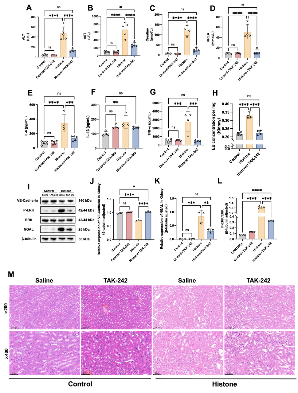 Figure 3 TLR-4 inhibitor significantly improved histone-induced renal dysfunction and organ hyperpermeability. (A)ALT, (B)AST, (C)Scr and (D) BUN levels in different groups of mice.  (E-G) IL-6, IL-1β, and TNF-α levels in serum were determined using ELISA kits. (I-L) The protein expression level of VE-Cadherin, NGAL, p-ERK and ERK in the kidneys were analyzed by western blot analysis and quantified by densitometry. (H) Relative levels of renal Evans Blue Dye (EBD)  absorbance at 610 nm in sham and septic mice with or without TAK-242 administration. (M) Representative images of HE staining (×200, scale bars = 150 μm; ×400, scale bars = 60 μm). Data are represented as the mean ± SD. *P ＜ 0.05, ** P ＜0.01, *** P ＜0.001, **** P＜0.0001.