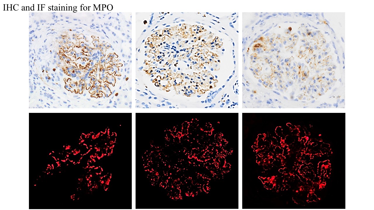 IHC and IF staining for MPO