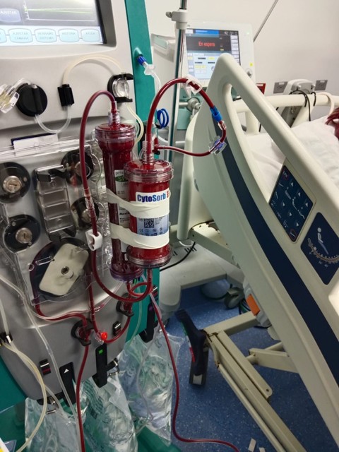 Hemoadsorption assembly using a PrismaFlex ® machine, a ST-150 filter and a CytoSorb® filter.