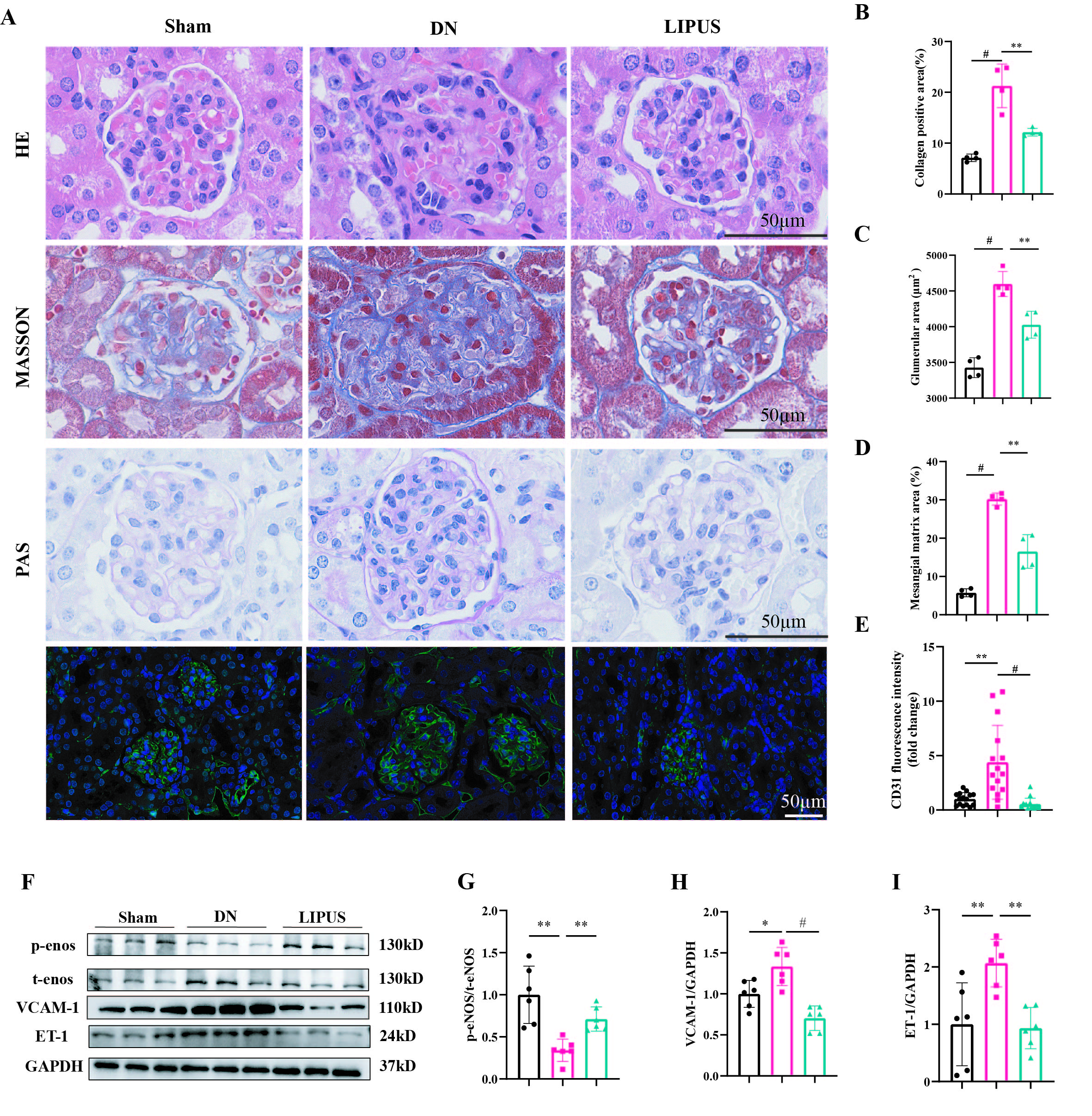 Figure 2 LIPUS treatment attenuates GEC damage in DN mice. (A) Representative H&E, Masson, PAS-stained and CD31 (green) immunofluorescence images of mouse kidneys. Scale bar, 50 um. (B) Quantification of average collagen positive area (n=4). (C) Quantification of mesangial matrix fraction (n=4). (D) Quantification of glomerular area (n=4). (E) Quantitative analysis of the CD31 fluorescence intensity (n=4). (F) Representative western blot images of p-enos, t-enos, VCAM-1 and ET-1 in renal cortex. (G) Quantitative analysis of p- eNOS protein expression normalized to t-eNOS (n=6). (H) Quantitative analysis of Vcam-1 protein expression normalized to GAPDH (n=6). (I) Quantitative analysis ET-1 protein expression normalized to GAPDH (n=6).  Data are presented as mean ± SD.  *P < 0.05, **P < 0.01, ***P < 0.001, and #P < 0.0001. LIPUS, Low-Intensity Pulsed Ultrasound; GEC, glomerular endothelial cell; DN, Diabetic Nephropathy; H&E, Hematoxylin and Eosin; PAS, Periodic Acid–Schiff.