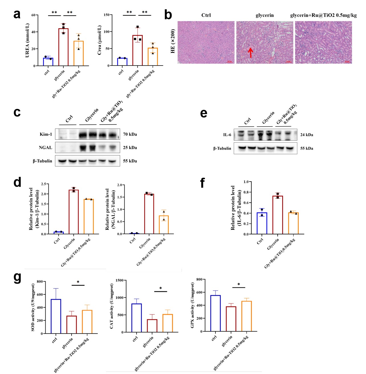 Protective effect of Ru@TiO2 nanozyme in AKI mice.