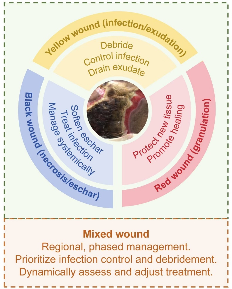 Fig 2. Key Considerations for Wound Care in Patients with Calciphylaxis