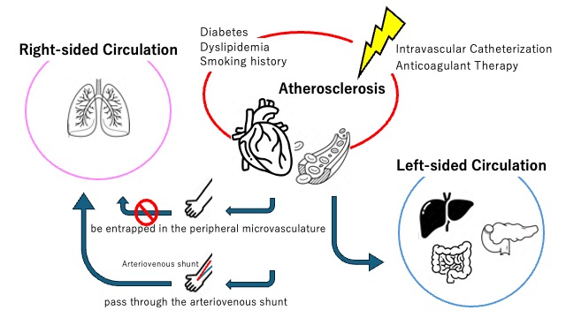 Figure. Schematic illustration of the proposed mechanism. Cholesterol crystals from the shaggy aorta entered the systemic circulation and reached the lungs through the arteriovenous fistula, causing pulmonary cholesterol embolism.