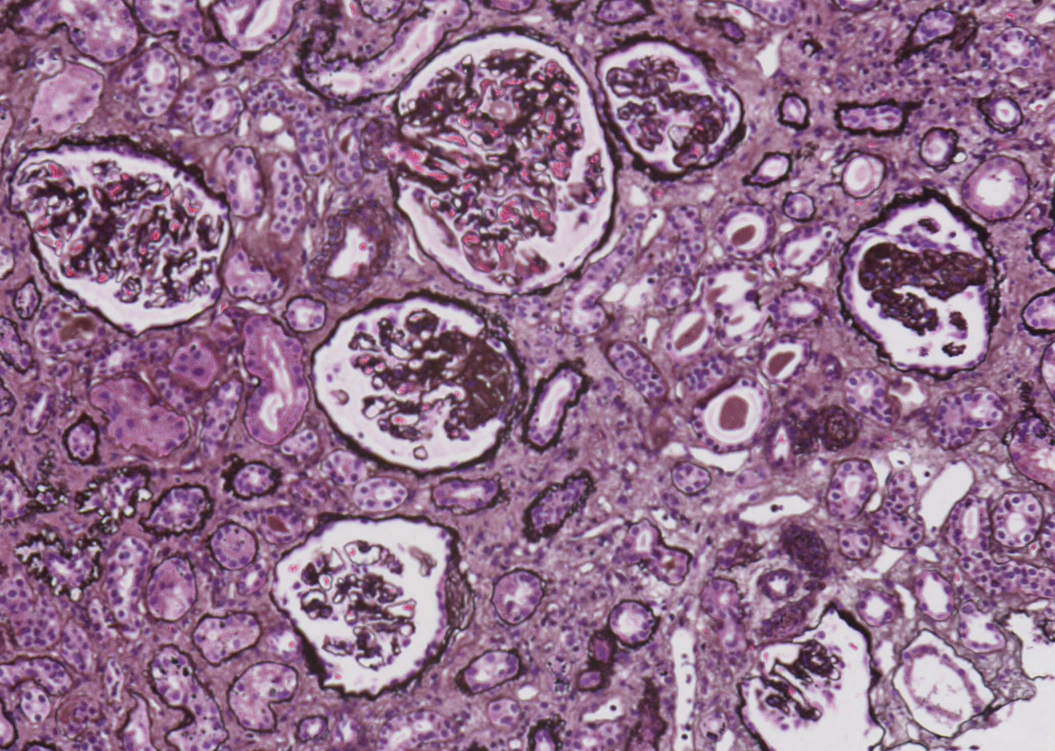 Renal Pathology 1