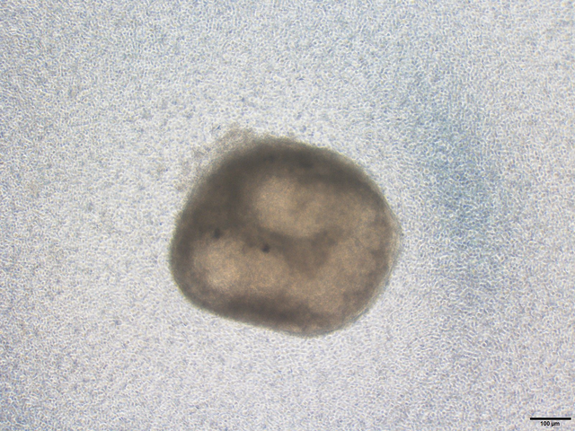The elongated ureteral organoid integrating mouse ESC-derived ureteral stromal progenitors and mouse embryo-derived ureteral epithelial progenitors