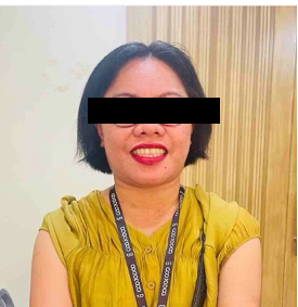After balloon venoplasty