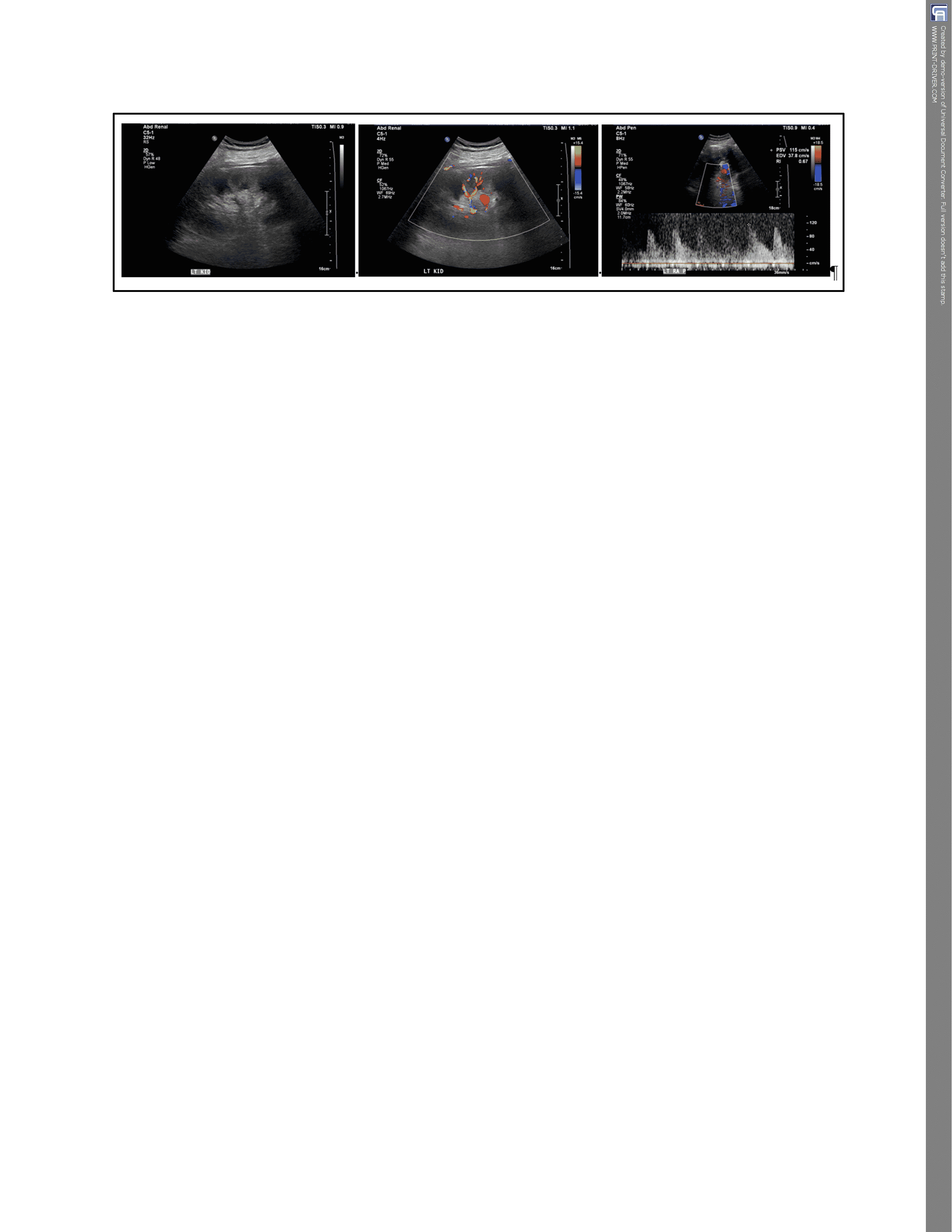 Left renal sonogram and left renal artery and vein Duplex examination on post-operative day 1.