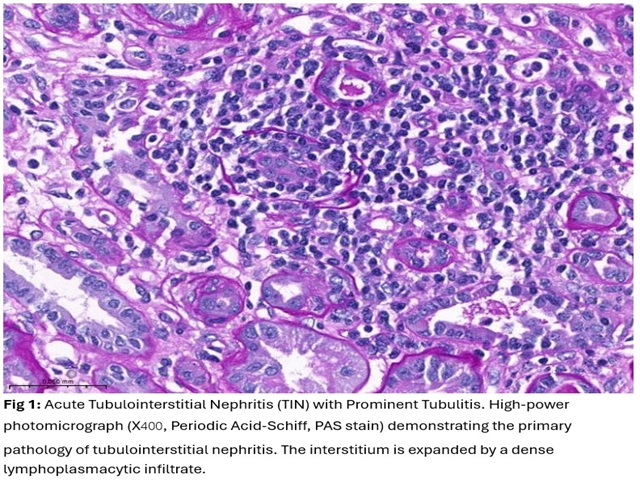 Renal biopsy