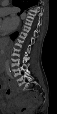 Rugger jersey spine