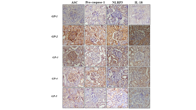 NLRP3 Complex