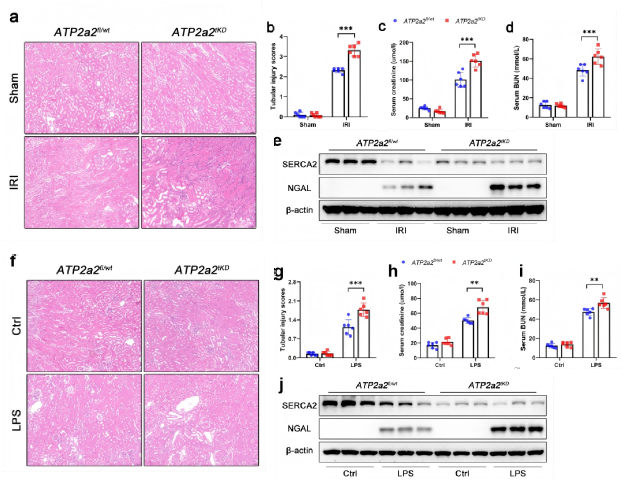 (a) Representative images of hematoxylin and eosin (HE) staining of kidney sections from control mice (ATP2a2fl/wt) and SERCA2 conditional knockdown mice (ATP2a2tKD) induced by IRI. (b) Tubular injury scores of kidney tissues. (c, d) Serum creatinine (SCr) and blood urea nitrogen (BUN) levels of ATP2a2fl/wt and ATP2a2tKD mice induced by IRI. (e) Western blot analysis and of SERCA2 and NGAL expression in kidney from kidney samples from ATP2a2fl/wt and ATP2a2tKD mice induced by IRI. (f) Representative images of HE staining of kidney sections from ATP2a2fl/wt and ATP2a2tKD mice induced by LPS. (g) Tubular injury scores of kidney tissues. (h, i) SCr and BUN levels of ATP2a2fl/wt and ATP2a2tKD mice induced by LPS. (j) Western blot analysis of SERCA2 and NGAL expression in kidney from TP2a2fl/wt and ATP2a2tKD mice induced by LPS.