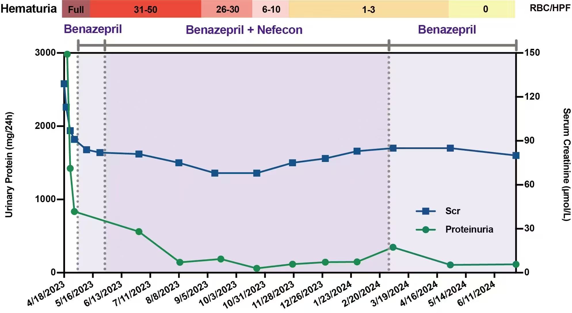 Figure2 Change in 24h proteinuria, serum creatinine and hematuria from baseline over the Nefecon treatment phase and follow-up phase. Scr, serum creatinine. RBC, red blood cells. HPF, high power field.