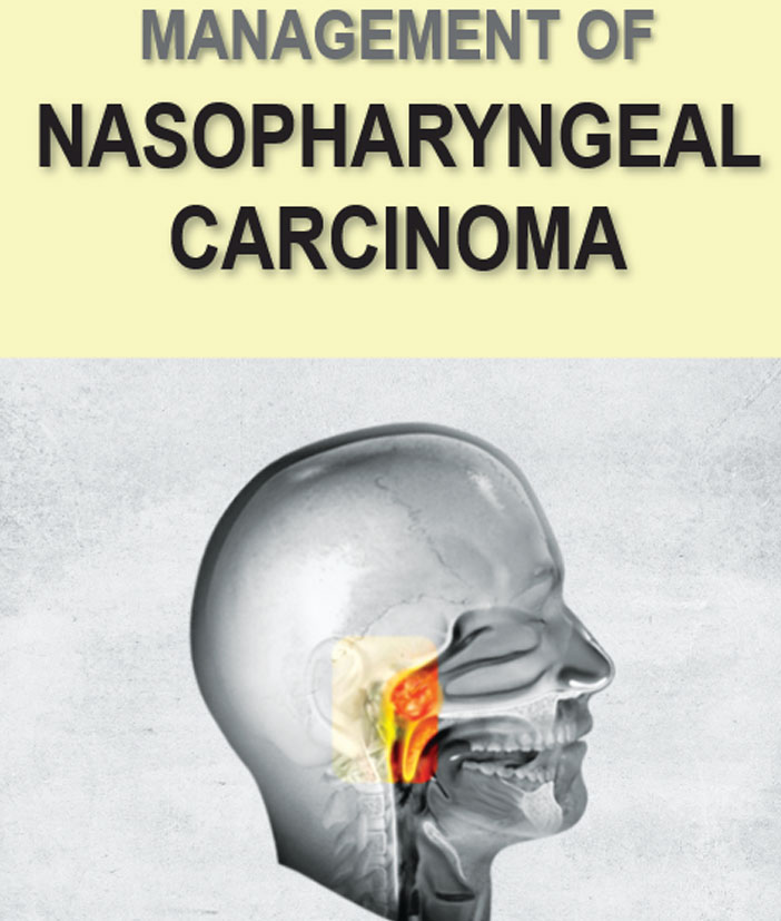 QR-Nasopharyngeal-Carcinoma