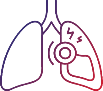 Pulmonary Circulation