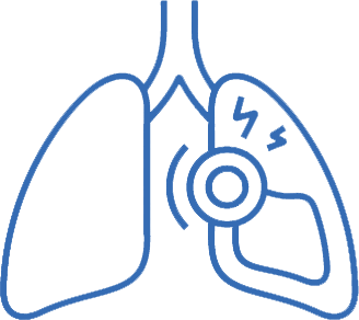 Pulmonary Circulation