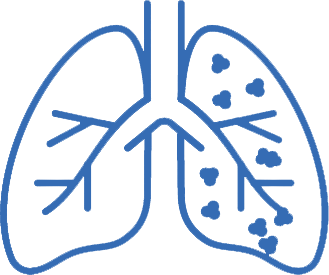  COPD