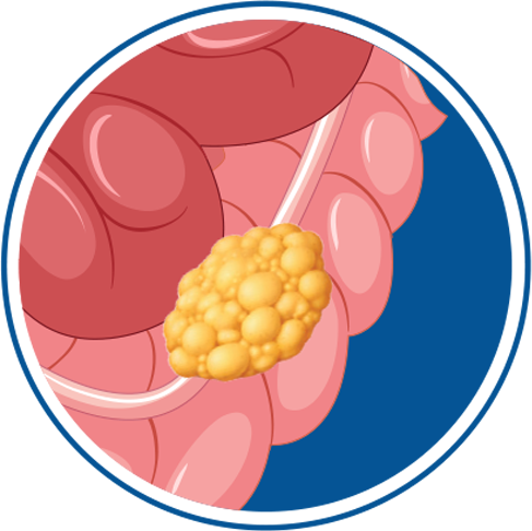 Stage 2