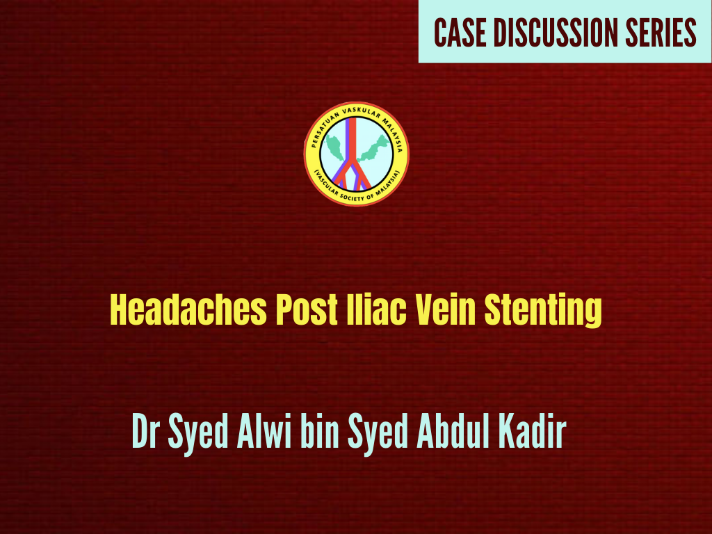 Headaches Post Iliac Vein Stenting