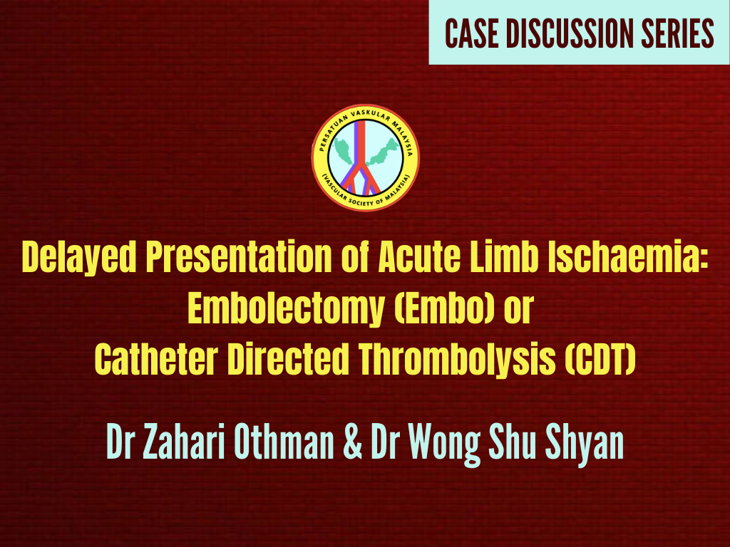 Delayed Presentation of Acute Limb Ischaemia: Embolectomy (Embo) or Catheter Directed Thrombolysis (CDT)
