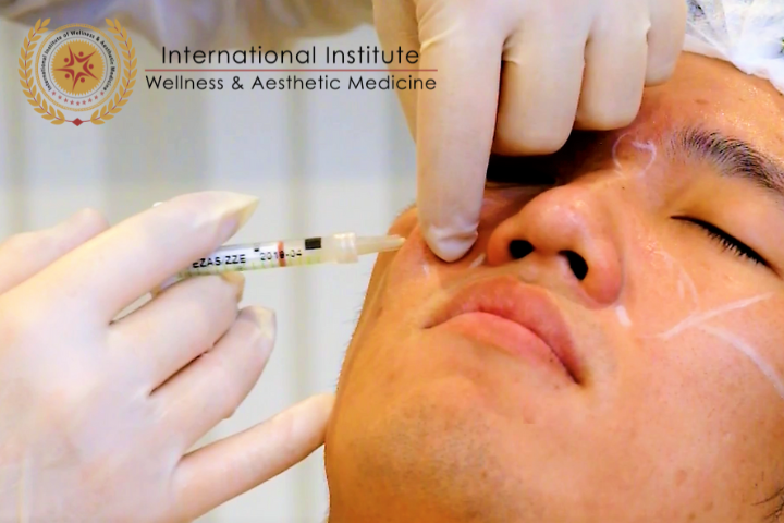 FACTS ABOUT DERMAL FILLER INJECTIONS