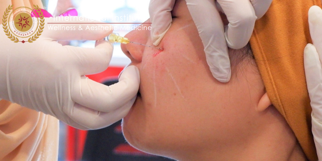  skin booster injection