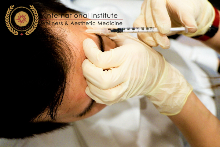 TREATMENT OF ACNE WITH BOTOX