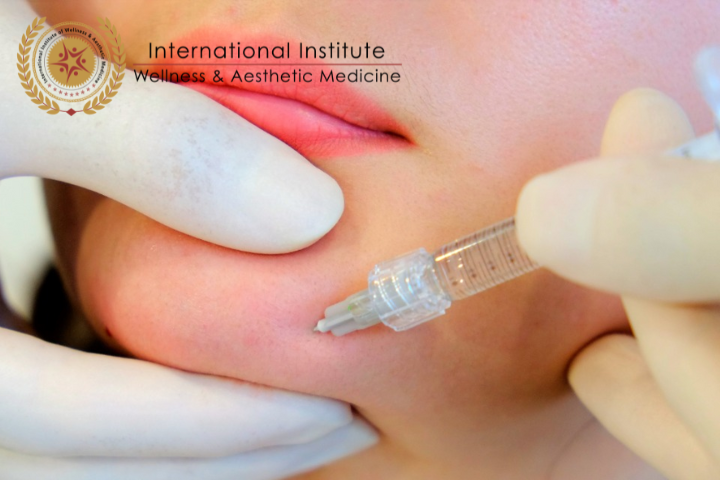 ABOUT DERMAL FILLERS