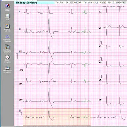 Electrocardiography software