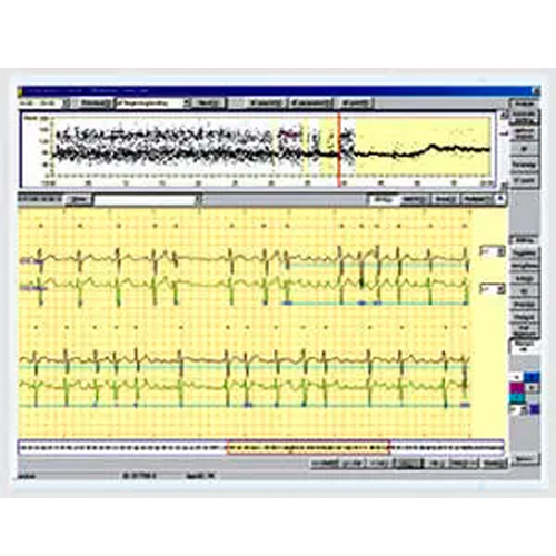 Cardiac Holter monitor software