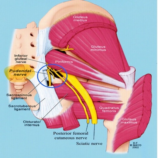 When the Tests Are Clear but the Pain Remains: Understanding Diffuse Genital Pain and Pudendal Neuralgia
