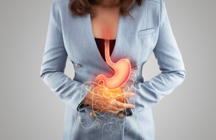 Gastric Reflux Pain - Its Symptoms And How Physiotherapy Works